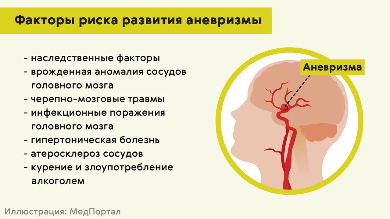 Симптомы аневризмы головного. Аневризма головного мозга симптомы. Аневризма мозга симптомы.