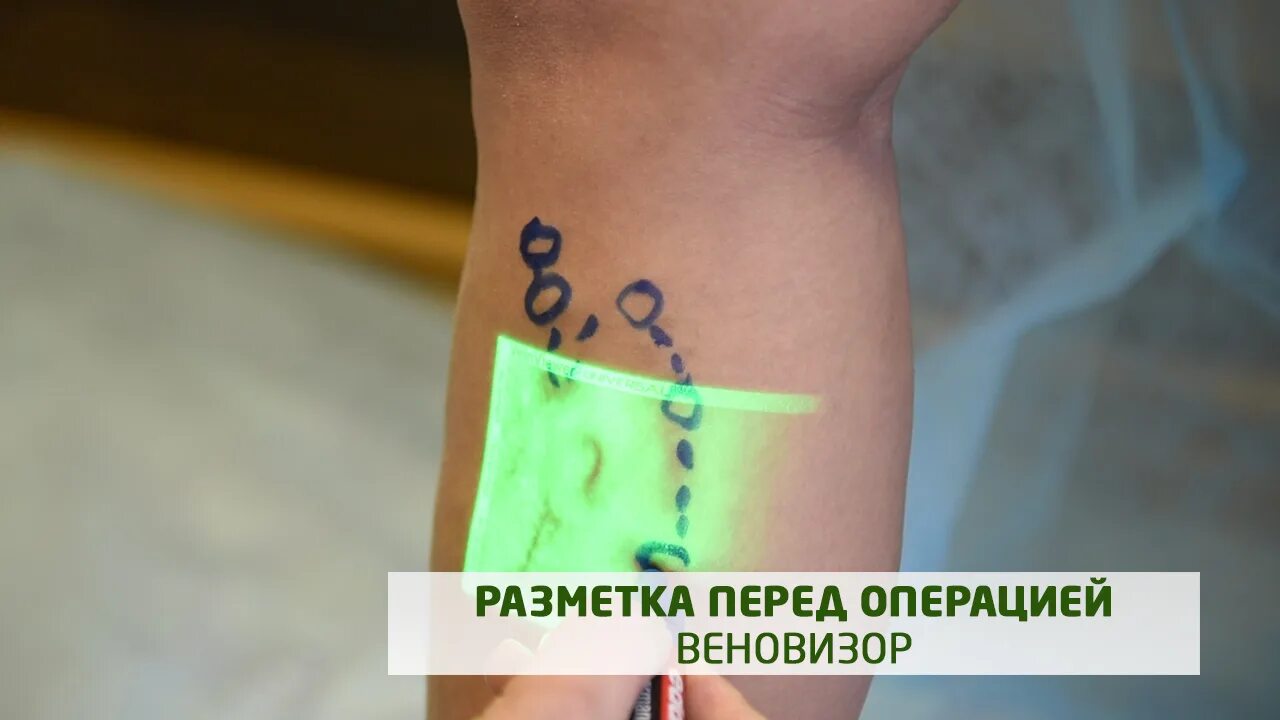 Разметка это операция по