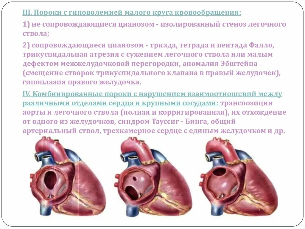 Причины. Гиповолемия малого круга. Гиперволемия. Гиперволемия малого круга кровообращения. Пороки с обеднением большого круга кровообращения у детей.