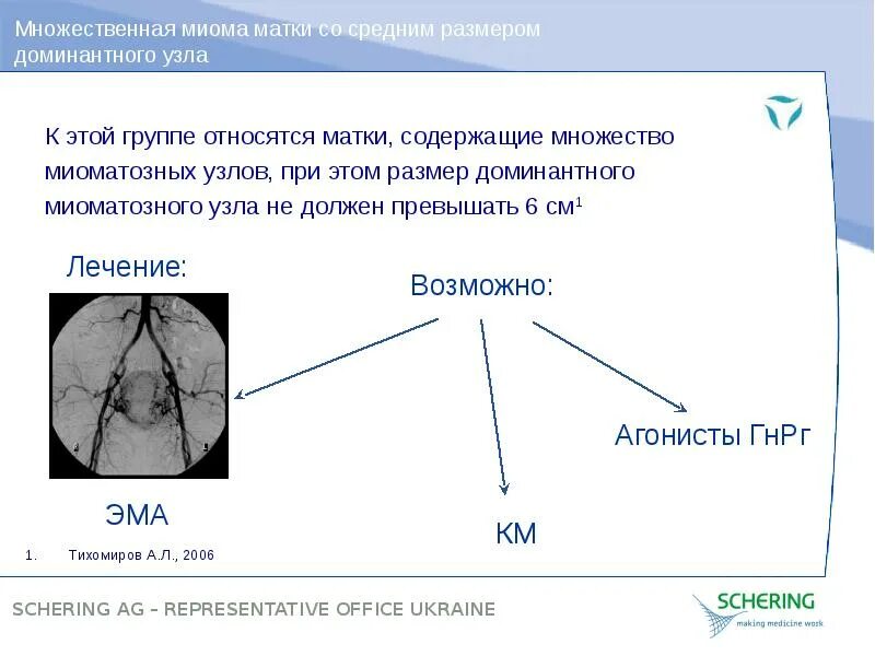 Множественная миома матки. Миома матки множественные миомы матки. Многочисленные узлы миомы матки. Множественная миома матки симптомы. Миома матки стадии