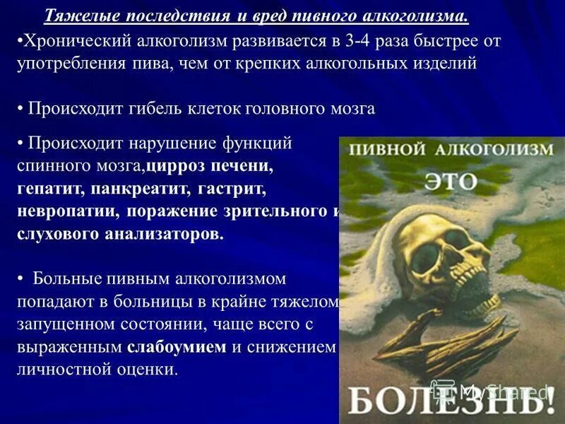 Признаки пивной зависимости. Пивной алкоголизм последствия. Сильное алкогольное опьянение. Алкоголизм. Пивной алкоголизм последствия.