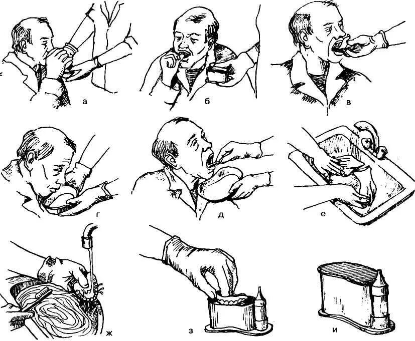 Обработка ротовой полости алгоритм. Обработка полости рта тяжелобольным алгоритм. Уход за полостью рта тяжелобольного пациента. Обработка слизистой полости рта алгоритм.