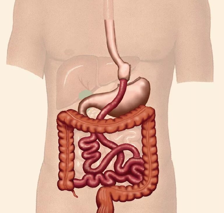 Бактериальный энтерит. Тенториум программа. Тенториум для желудочно-кишечного тракта. Таблетки для желудочно-кишечного тракта. Как восстановить желудочно кишечный тракт.