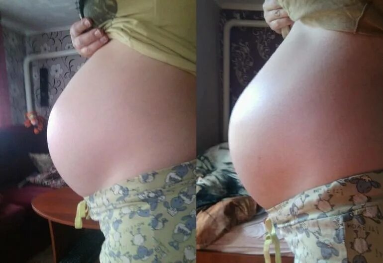 Опустился живот при беременности на 36 неделе. Опущение живота беременность. Опущенный живот беременной. Опущение живота перед родами. 38 39 неделя года