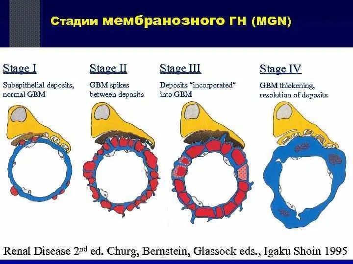 Stage 3. Stage 1. Stage 2. Stage 1 2 3 что это.