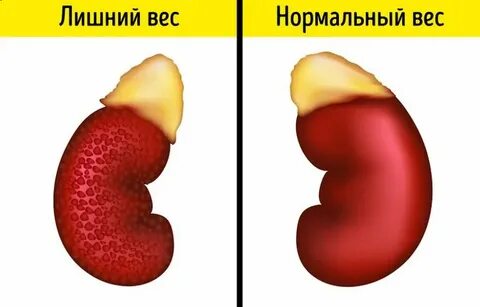 Ожирение почках