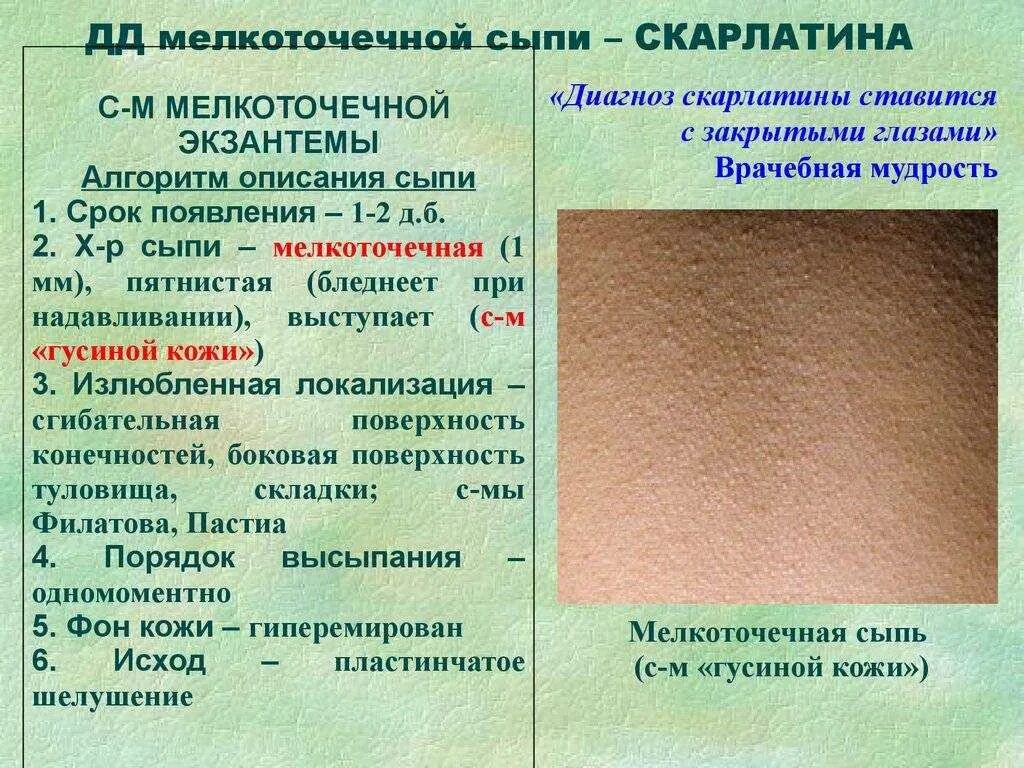 Температура кожных покровов. Мелкоточечная сыпь дифференциальный диагноз. Мелкоточечная сыпь на туловище.