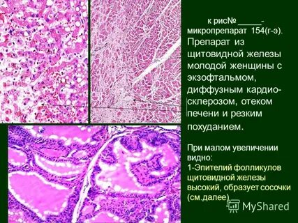 Фолликулы гипофиза