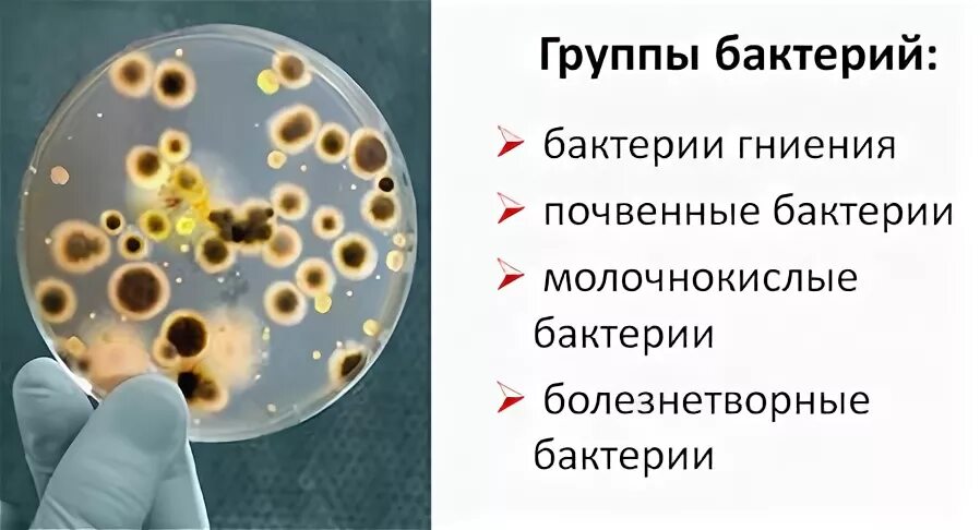 6 групп бактерий. Группы бактерий. Роль групп бактерий в природе. Почвенные бактерии и бактерии гниения. Почвенные болезнетворные бактерии.