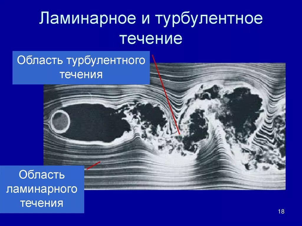 Течение 3 мс. Ламинарный и турбулентный поток жидкости. Ламинарное и турбулентное течение. Ламинарнон и тубуленьное тесение. Ламнарное и турубулетное тесение.