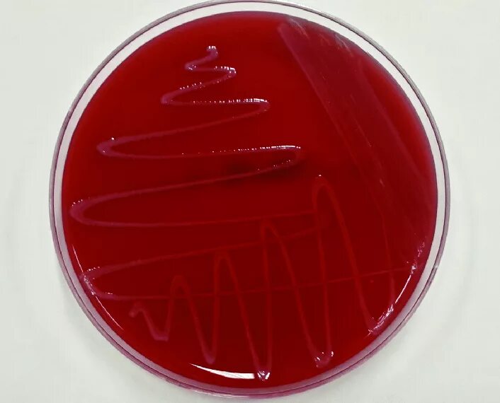 Listeria rj. Listeria monocytogenes (листерии). листерия моноцитогенес на агаре алоа. листерии микробиология.
