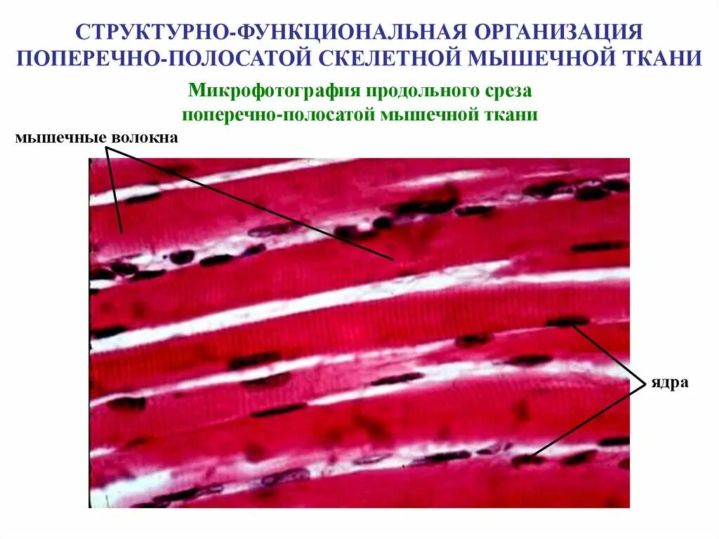 Изображение поперечно полосатой скелетной мышечной ткани. Поперечнополосатая сердечная мышечная ткань. Поперечнополосатая Скелетная мышечная ткань строение. Скелетная мышечная ткань гистология препарат. Поперечнополосатая сердечная мышечная ткань гистология препарат.