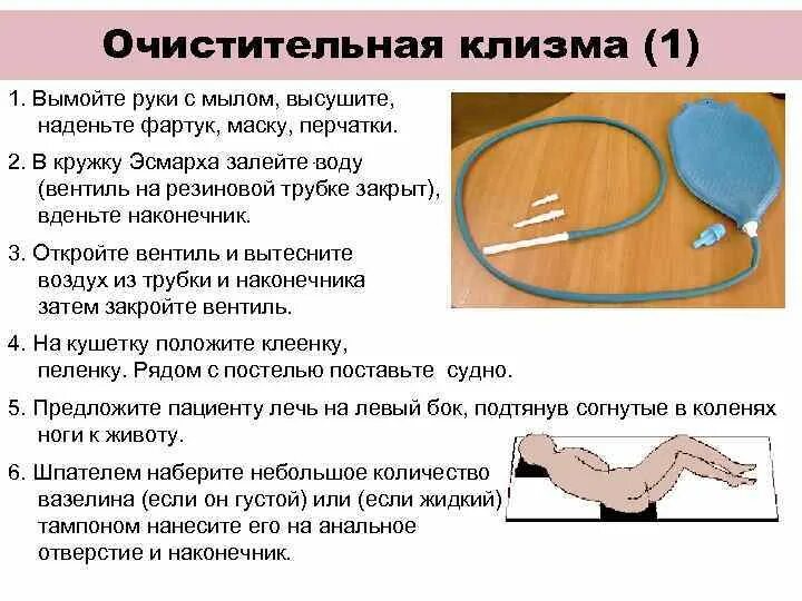 Методика постановки очистительной клизмы. Клизма алгоритм выполнения. Очистительная клизма алгоритм выполнения. Техника выполнения постановки очистительной клизмы. Необходимо для очистительной клизмы