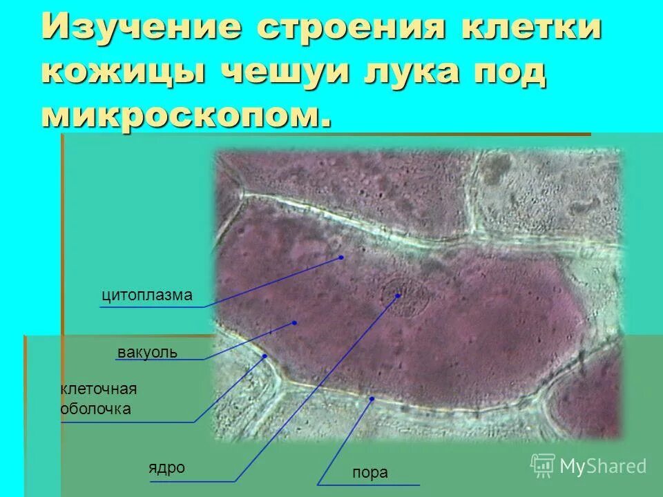 антоцианы под микроскопом. вакуоль электронная микрофотография. инфузории paramecium. цитология клетки растений. вакуоль под микроскопом.