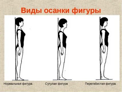 Осанка фигуры телосложение