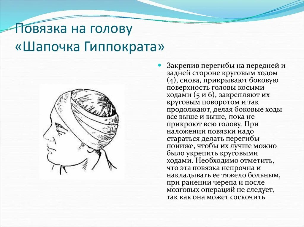 Повязка на голову размеры. Повязка чепец Гиппократа. Десмургия повязка чепец. Десмургия шапка Гиппократа. Повязки на голову десмургия.