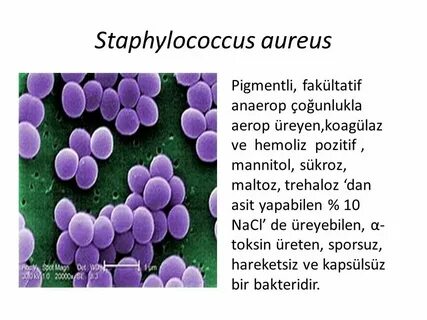 Стафилококк ауреус 10 в 4