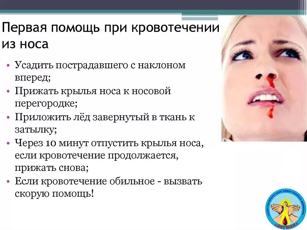 Почему часто течет кровь. При кровотечении из носа. Причины кровотечения из носа. Первая помощь при кровотечении ИД роса.