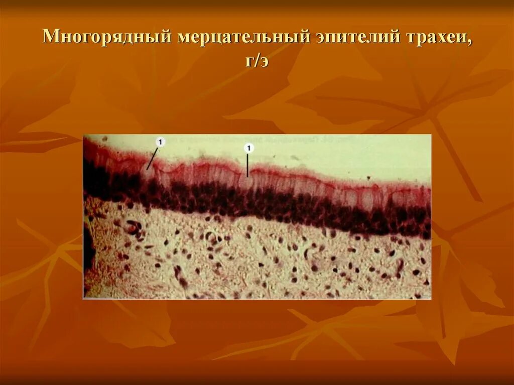 Эпителий выстилающий трахею. Однослойный многорядный реснитчатый мерцательный эпителий трахеи. многорядный призматический мерцательный эпителий трахеи препарат. многоядерный мерцательный эпителий трахеи. однослойный мерцательный эпителий препарат.