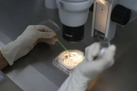 Соскоб тверь