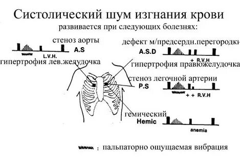 Шумы с левой стороны