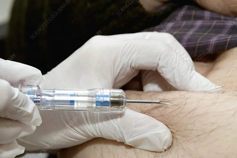 Укол от рака. Укол от рака. Укол шприцом. Дипроспан для инъекций. Вакцинация фотосток.