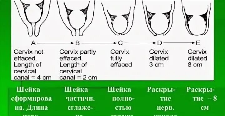 Почему шейка