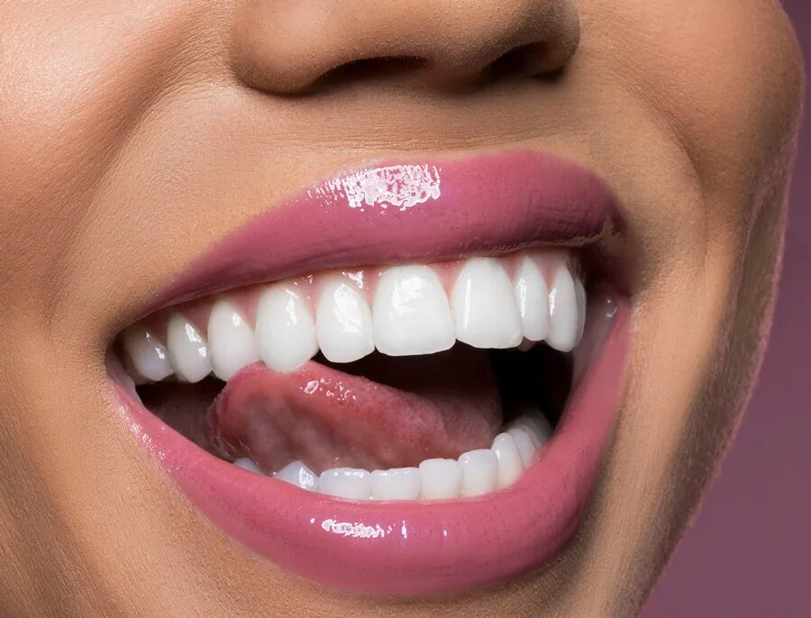 Белоснежные зубы. Красивые ровные зубы. Красивые зубы. Девушка с красивыми зубами. Всякие зубы.