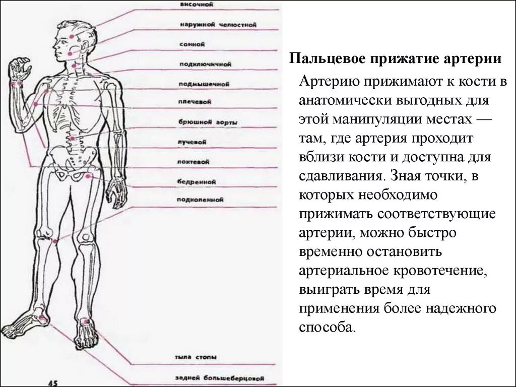 Точки прижатия при кровотечении схема. Схема пальцевого прижатия артерий. Точки прижатия артерий схема. Точки пальцевого прижатия артерий схема.