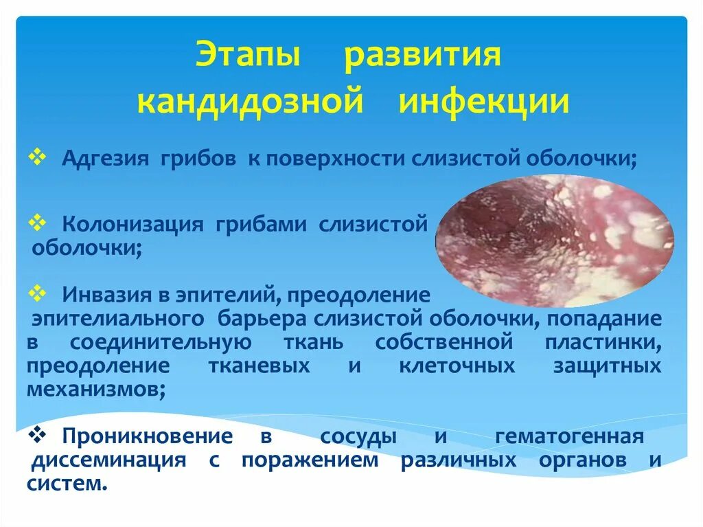 Адгезия грибов. Инфекционные заболевания адгезия. Этапы адгезия колонизация. В развитии кандидозной инфекции различают этапы:. Инфекционные заболевания грибы