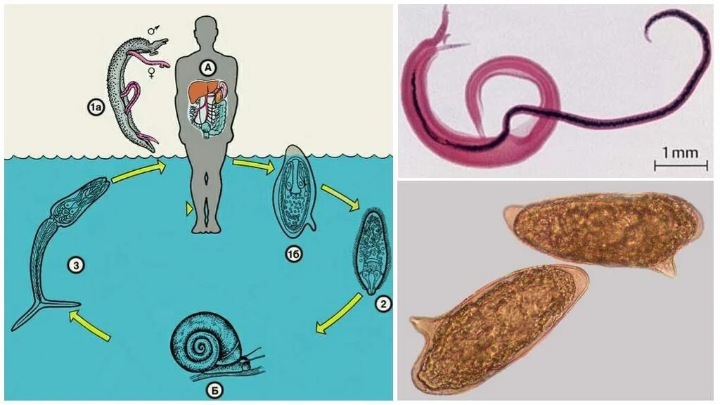 Жизненный цикл шистосомы. Кровяной сосальщик шистосома. Жизненный цикл шистосом. Цикл развития кровяного сосальщика. Schistosoma mansoni жизненный цикл.