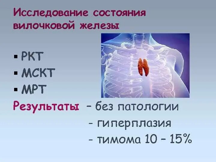 Тимома вилочковой железы. Опухоль вилочковой железы. Опухоль в вилочковой железе. Опухоли средостения тимома. Тимома переднего средостения.