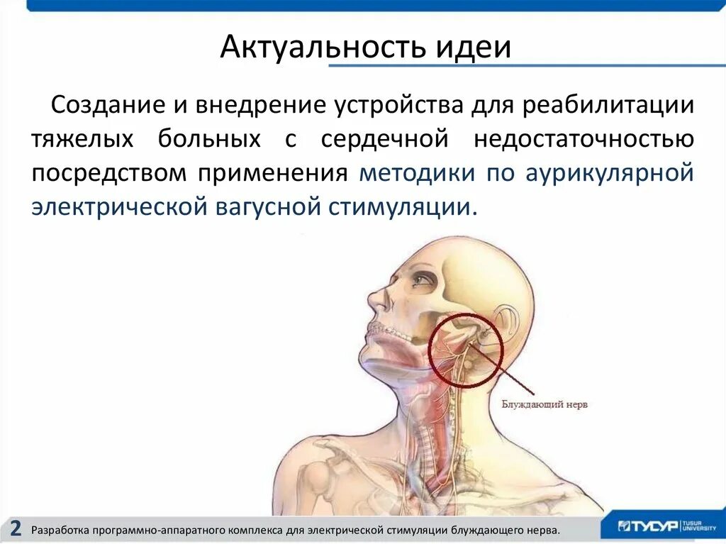 Стимулятор блуждающего нерва. Аппарат для стимуляции блуждающего нерва. Стимуляция блуждающего нерва. Электростимуляция блуждающего нерва. Стимулятор блуждающего нерва эпилепсии.