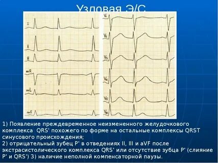Р после 3