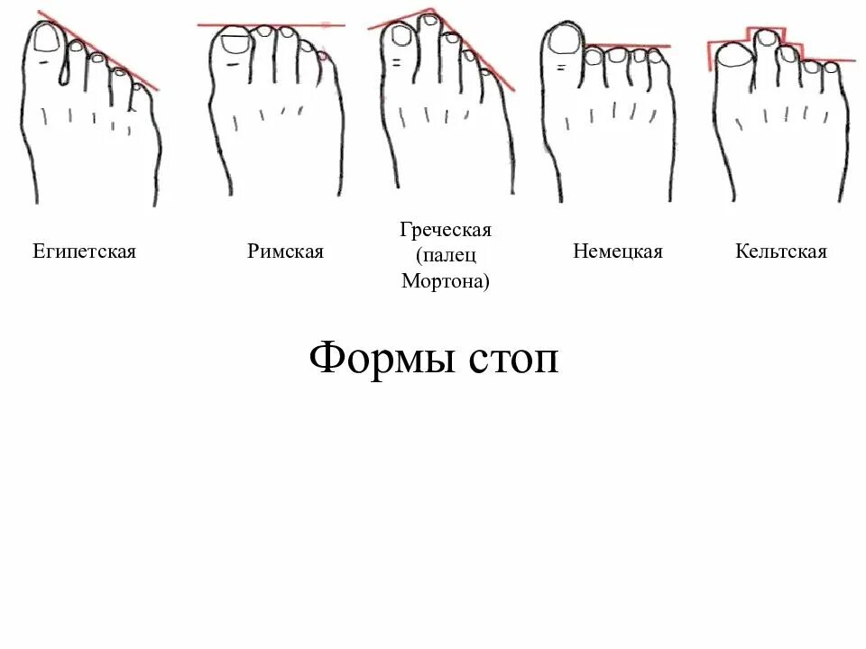 Греческая стопа Римская стопа Египетская стопа. Форма стопы Египетская Греческая. Форма стопы Римская Греческая. Форма пальцев стопы. 3 типа стопы