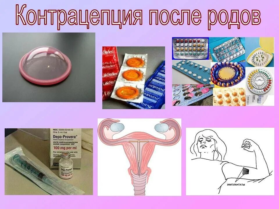 Самый хороший способ предохранения. Послеродовая контрацепция. Контрацепция после родов. Противозачаточные способы. Методы контрацепции после родов.