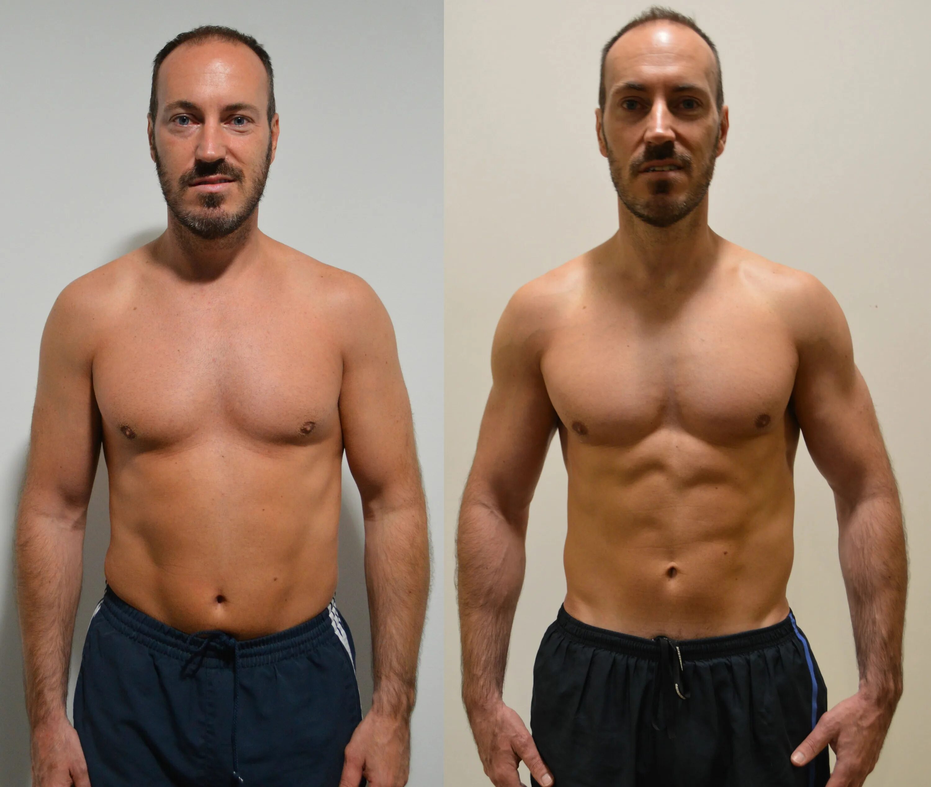 Морщины до после. Before and after. Похудение до и после. Before and after. Лицо без морщин.