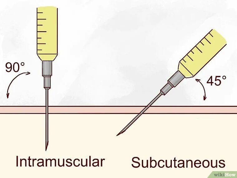 Как правильно держать шприц. 2/3 Длины иглы для укола. Иглы для внутримышечных инъекций в ягодицу. Игла для внутрикожной инъекции. Инъекции углы введения иглы.