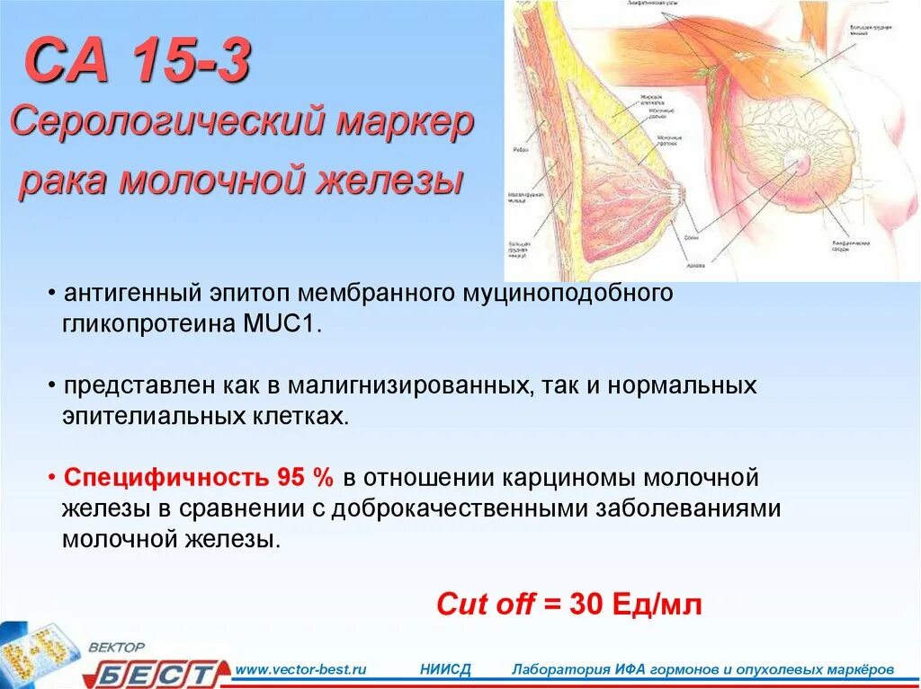 Онкомаркеры яичка. Онкомаркеры молочных желез. Маркеры опухоли молочной железы. Онкомаркеры для женщин молочной железы. Онкомаркеры на молочные железы.