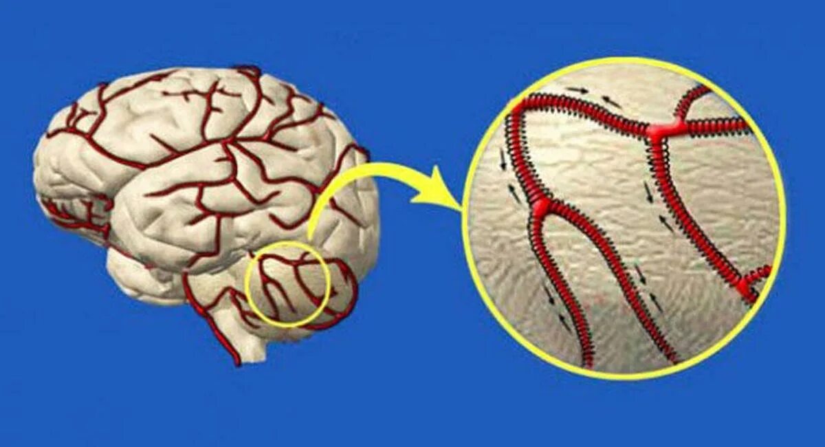 Сосуды головного мозга лечение народными. Коронарные сосуды головного мозга. Корень мозга. Капилляры головного мозга.