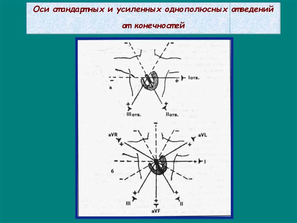 Ось стандартная. Оси стандартных отведений. Оси стандартного и усиленного отведения. Шестиосевая система координат ЭКГ. Шестиосевая система ЭКГ.