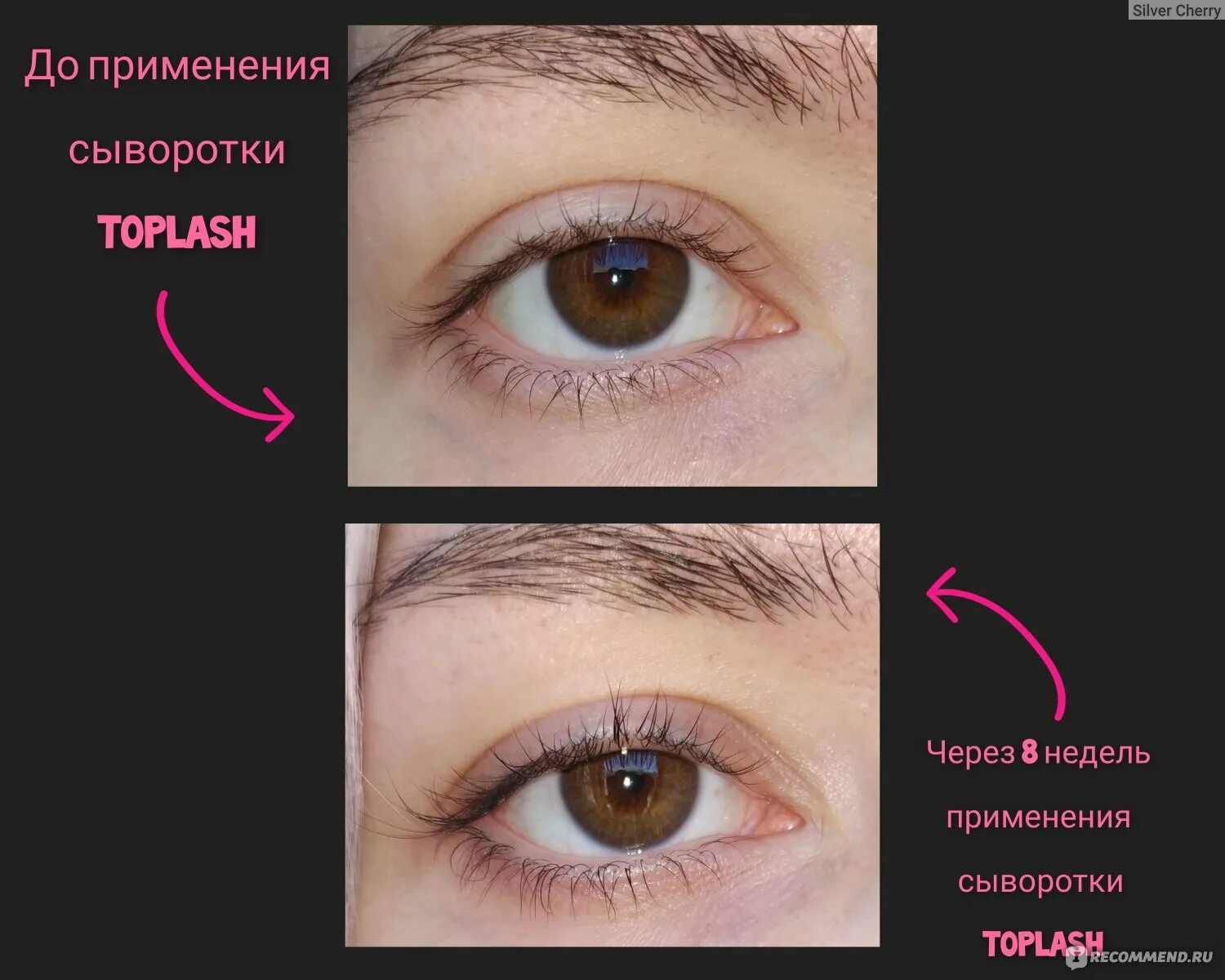 Toplash для роста ресниц отзывы. Сыворотка для роста ресниц toplash. бимоптик для ресниц. сыворотка для роста ресниц toplash xl. линейка для роста ресниц.
