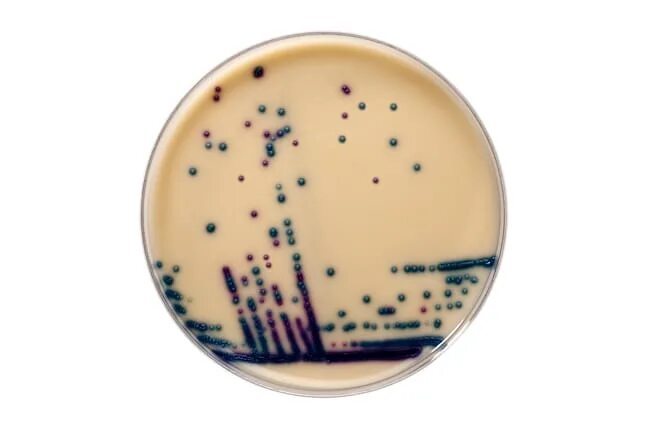 Enterococcus faecalis лечение. Энтерококки бактерии. vre энтерококк. энтерококк агар faecalis. enterococcus faecium под микроскопом.
