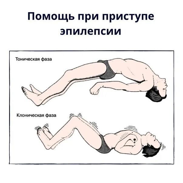 Тема эпилепсия. Помощь при эпилептическом припадке. Тонико-клонические приступы эпилепсии. Первая помощь при приступе эпилепсии. Приступ эпилепсии первая.