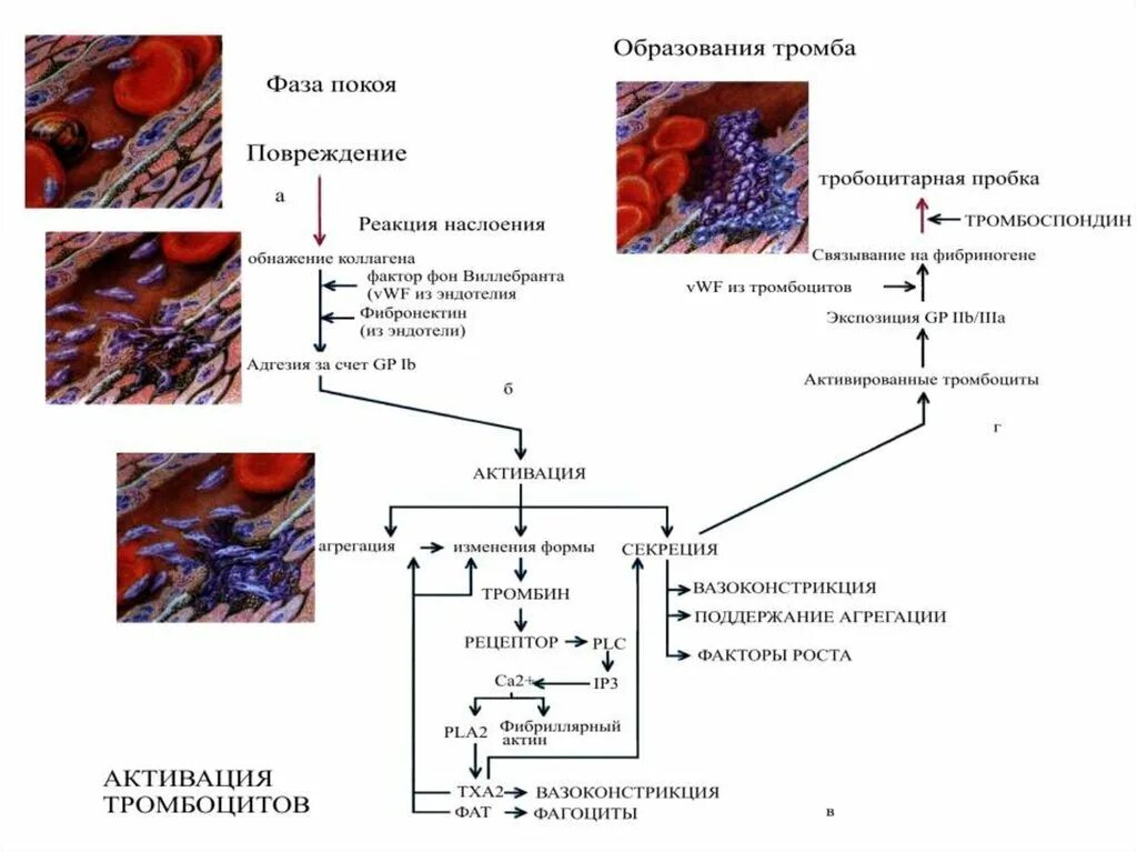 Механизм образования тромба схема. Образование тромба патанатомия. Механизм образования тромба рисунок. Схема образования кровяного сгустка тромба. Механизмы тромбов