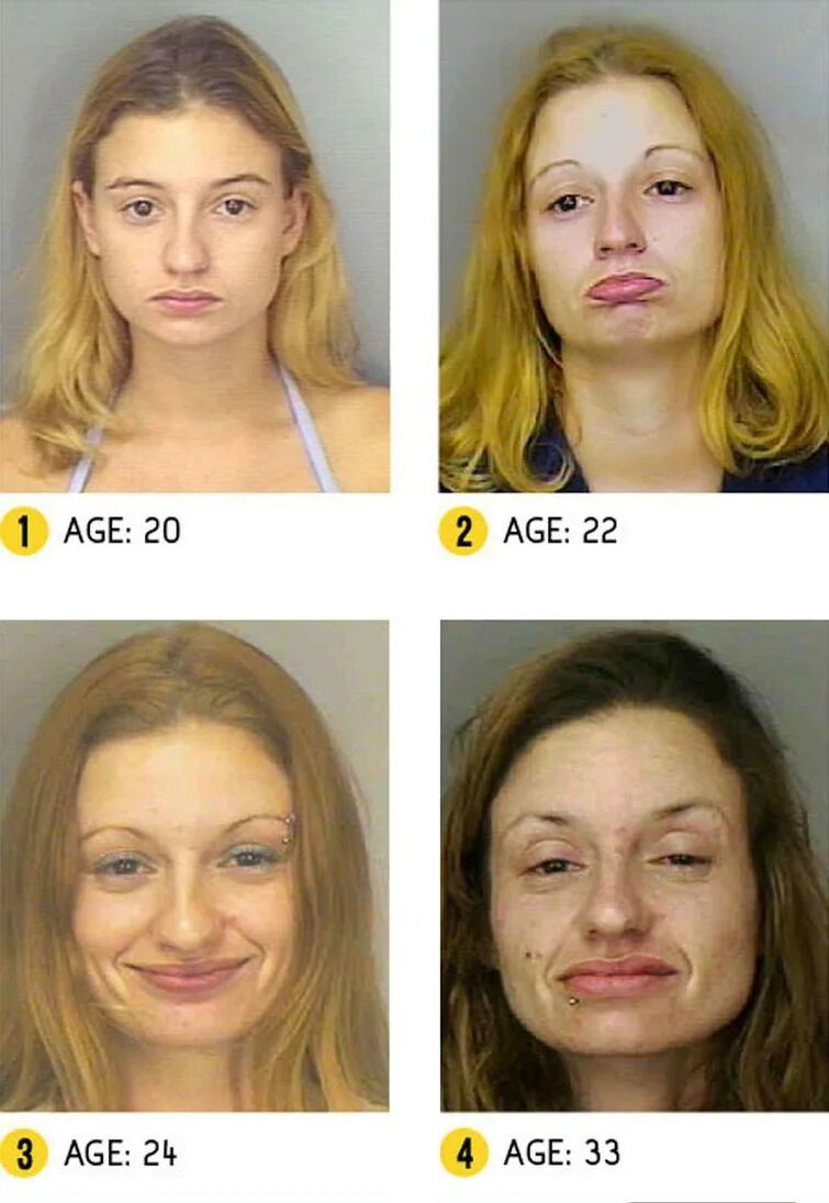 Курящие до и после. Лица наркоманов до и после. Лица метамфетаминщиков.