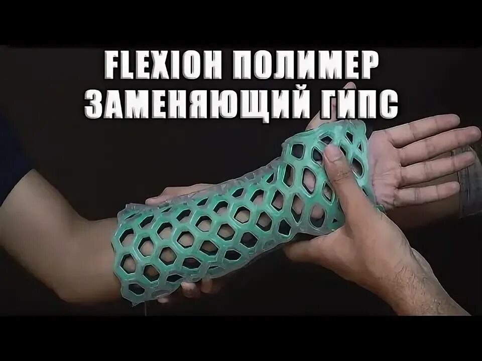 Чем заменить гипс в домашних условиях Снятие гипса YouTube