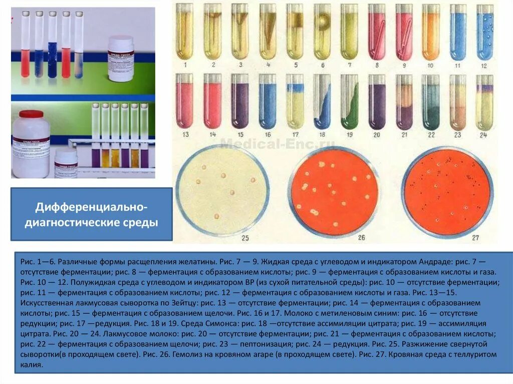 Плотные питательные среды микробиология. Универсальные питательные среды микробиология. Естественные питательные среды микробиология. Дифференциально-диагностические среды микробиология Гисса.