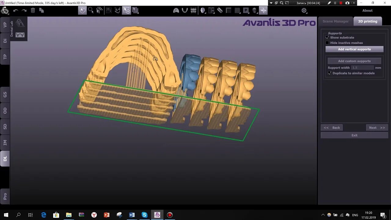 Авантис 3д. Авантис 3d аппарат. Авантис логотип. Avantis 3д стоматология. 3д моделирование в стоматологии.