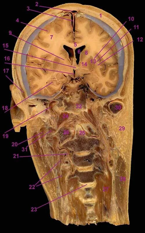 Sinus sagittalis superior